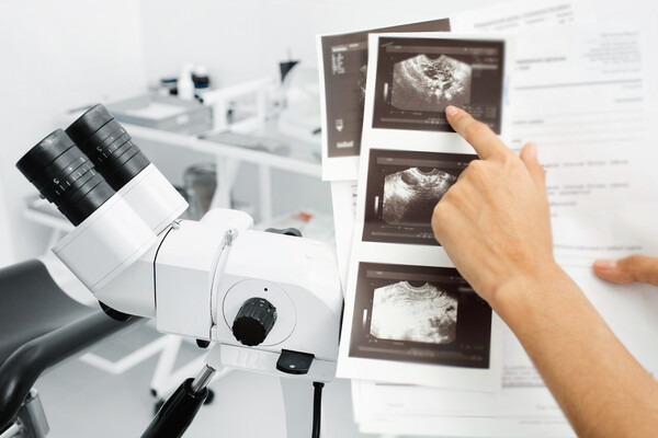 Doctor in lab pointing to ultrasound images of a uterus.