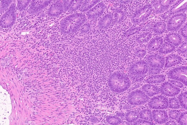 A microscopic image stained to show cells in the intestines