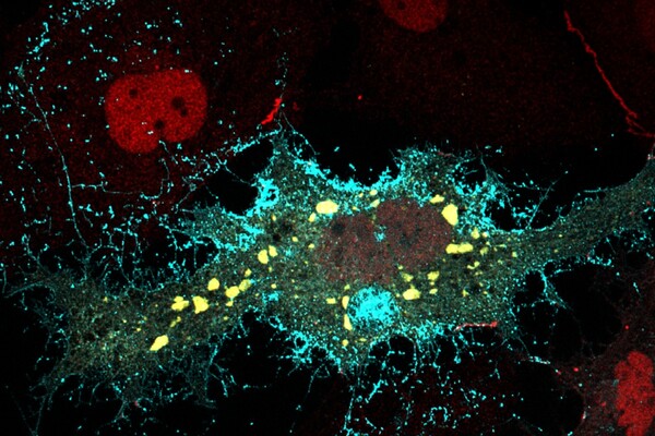 Ebola virus in cell.