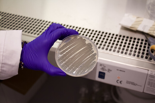 A petri dish of fungal matter in a lab.