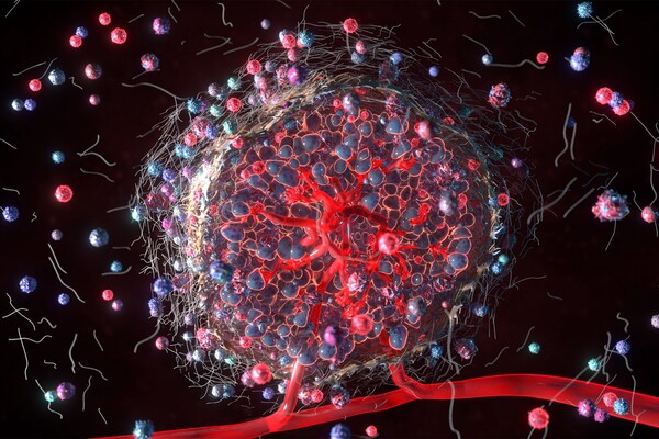 3D visualization showing a reddish-blue tumor mass with internal vasculature, surrounded by blue CAR T cells and small extracellular vesicles against a dark background.
