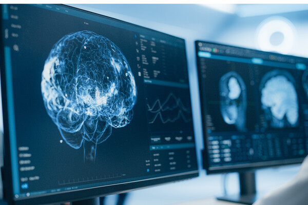 Medical brain scans on multiple computer screens.