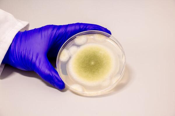 A sample of Aspergillus flavus 