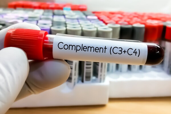 Hand holding a blood vial that reads "complement (C3 + C4)"