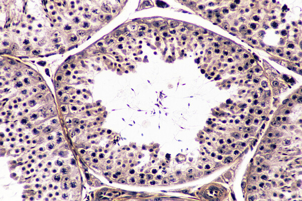 Spermatogenesis at a microscopic level