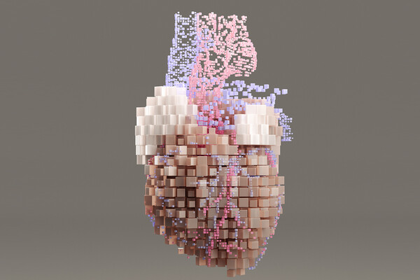 computational mapping of a human heart.