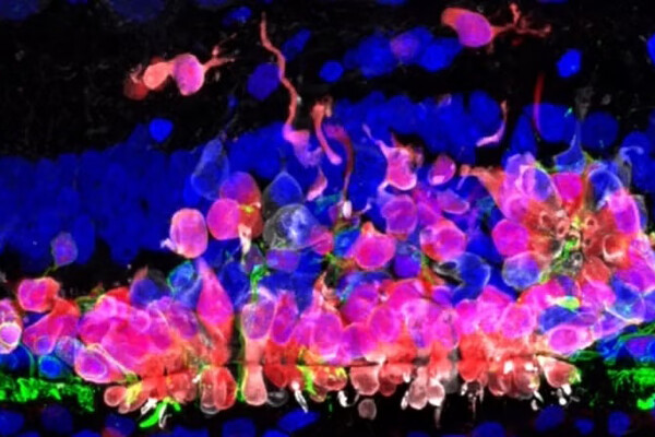 Microscopic view of transplanted human cells.
