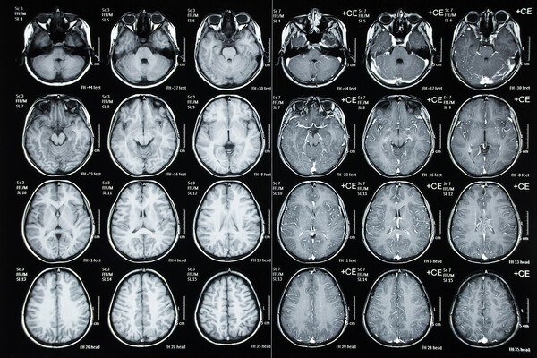 Sheet of a child’s brain scans.