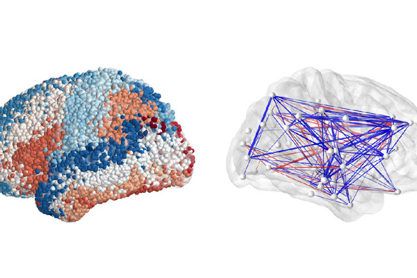 Brain mapping from the Penn-led Restoring Active Memory project. 