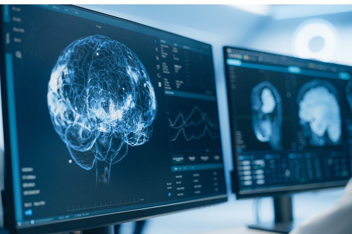 Medical brain scans on multiple computer screens.