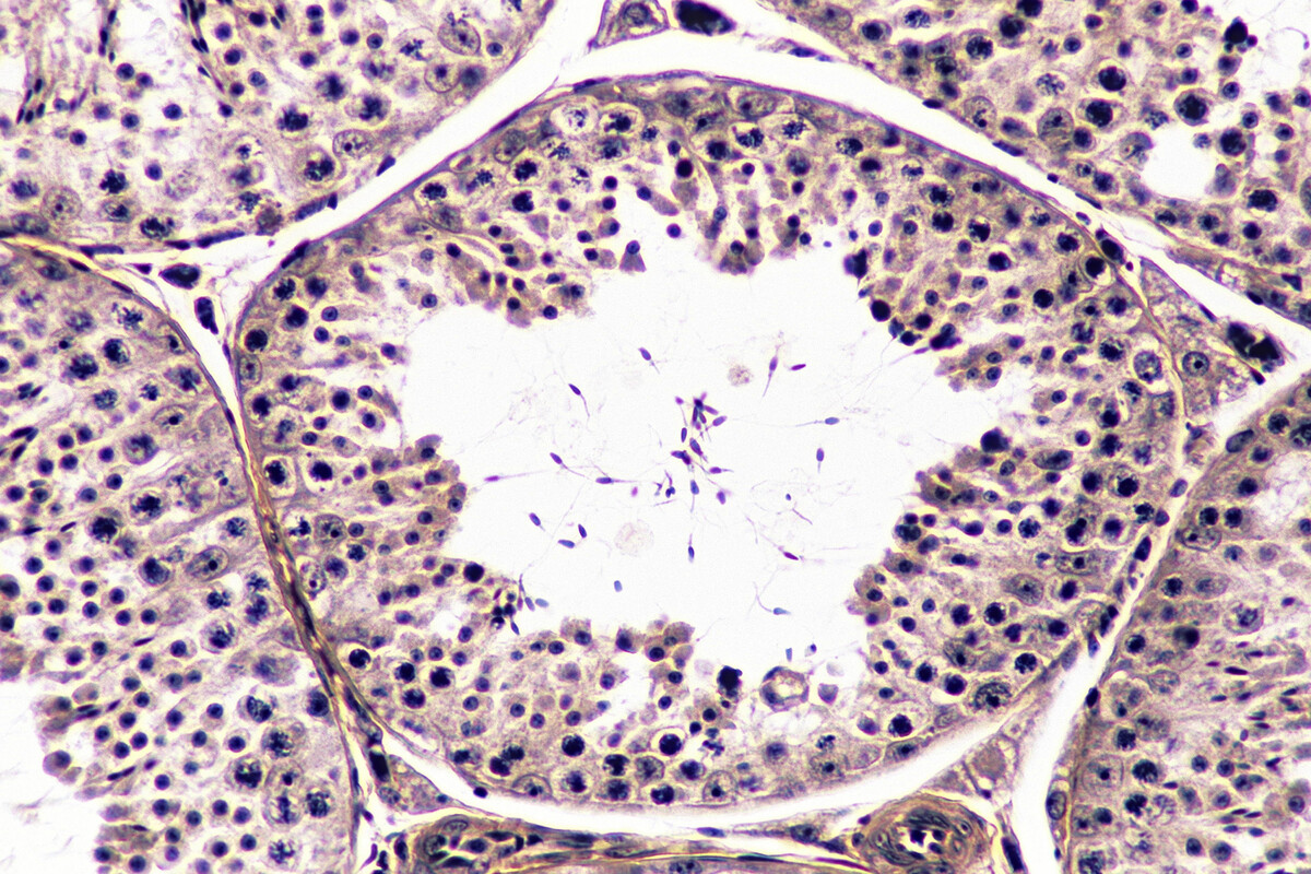 Spermatogenesis at a microscopic level